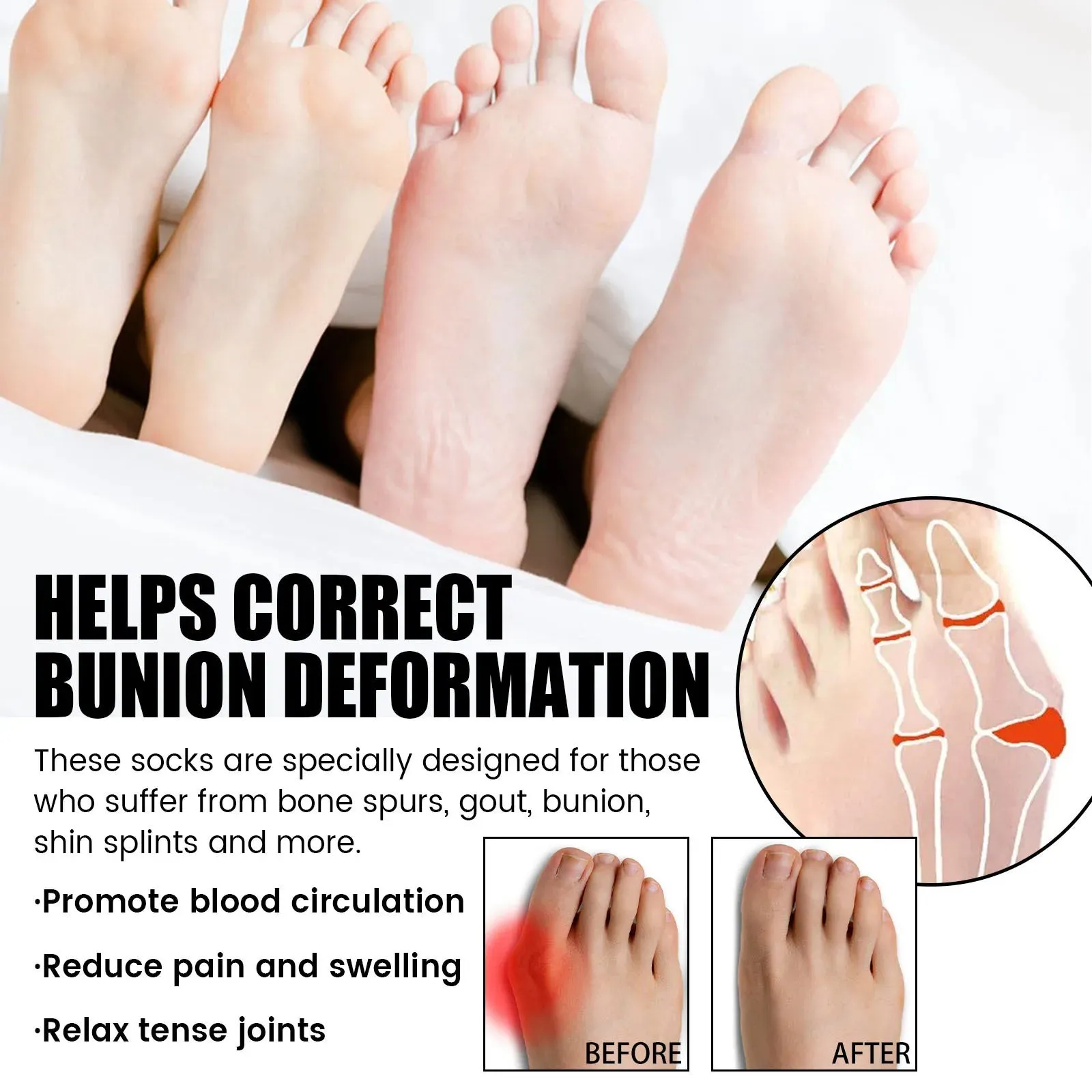 Orthofeet Bunion Relief Socks